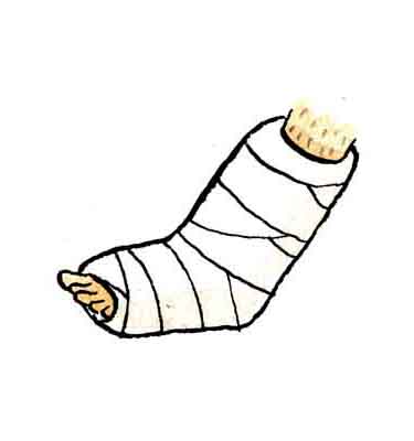 gips
